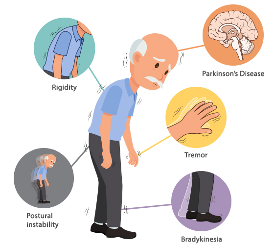 What Is The Clinical Definition Of Bradykinesia